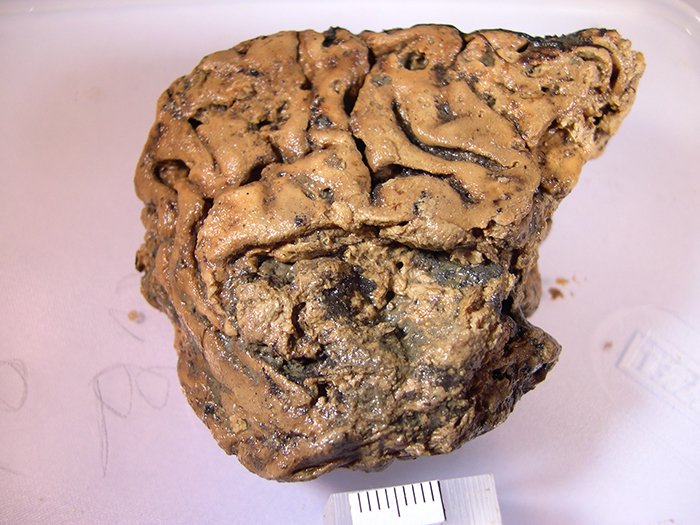 2600年間無傷で保存された、人間の脳組織が発見される