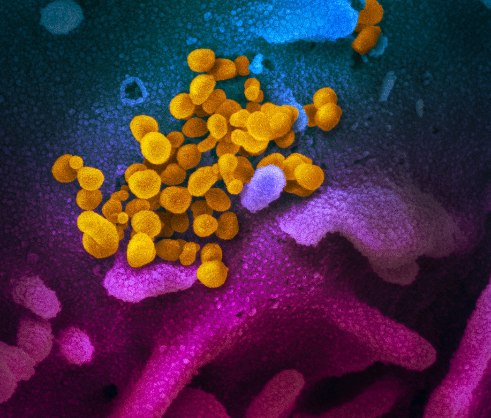 驚くほど芸術的なものだった、新型コロナウイルスの顕微鏡下での姿が公開される