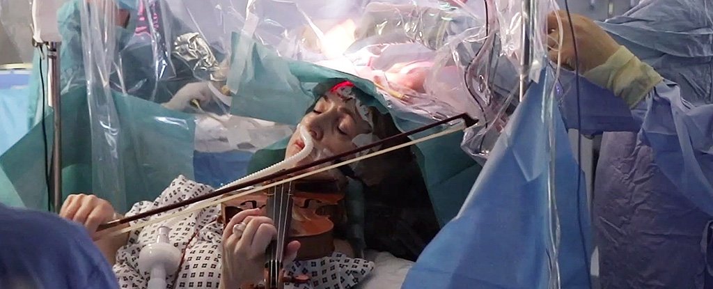 脳腫瘍切除中にバイオリン奏者が演奏を行う、前代未聞の手術が行われる