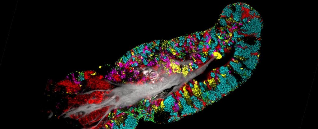 驚きの画像が示す私たちの舌の上のバクテリアコロニー