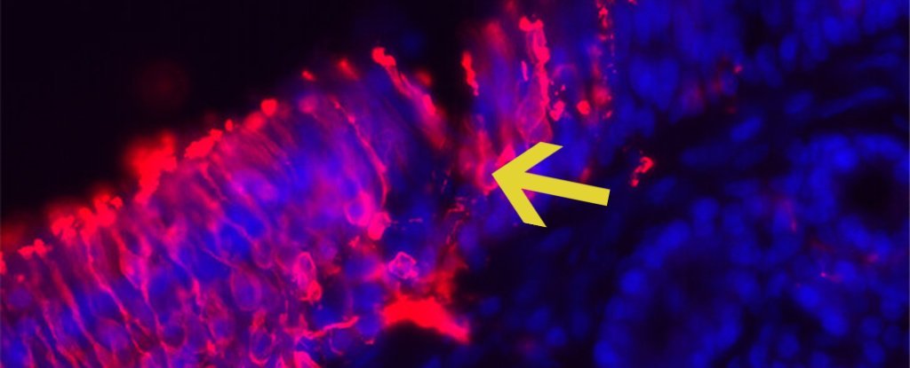生まれたばかりの神経細胞がすくすくと育つ「ニューロンの苗床」が成人男性の鼻の中に発見される