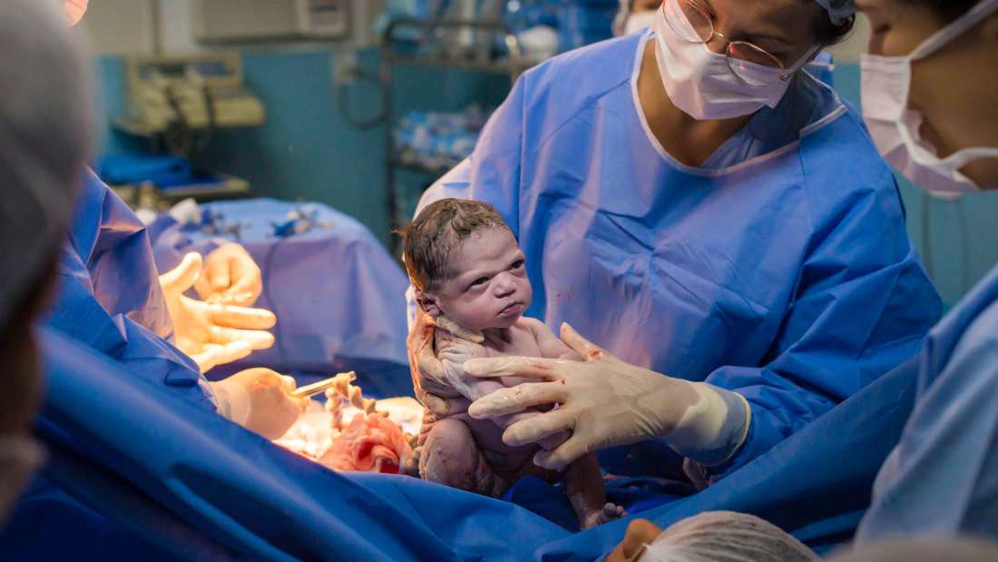 生まれて数秒の赤ちゃんが医師をにらめつける瞬間が撮影される