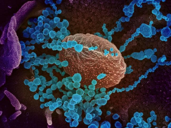 新型コロナウイルスは免疫細胞を破壊する能力があることが判明