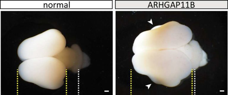 ヒトの遺伝子の助けを借りて猿の脳を肥大化させることに成功